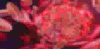 Imagem ilustrativa de Introdução a Hemoterapia e Hematologia