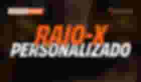 É uma imagem do post com o título Raio-X Personalizado: saiba o que priorizar na prova do concurso